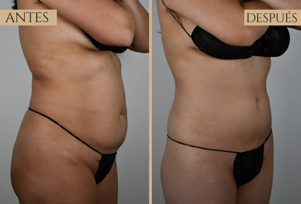 Antes-despues exp 1 (1)