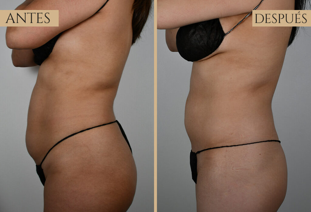 Antes-despues exp 1 (2)