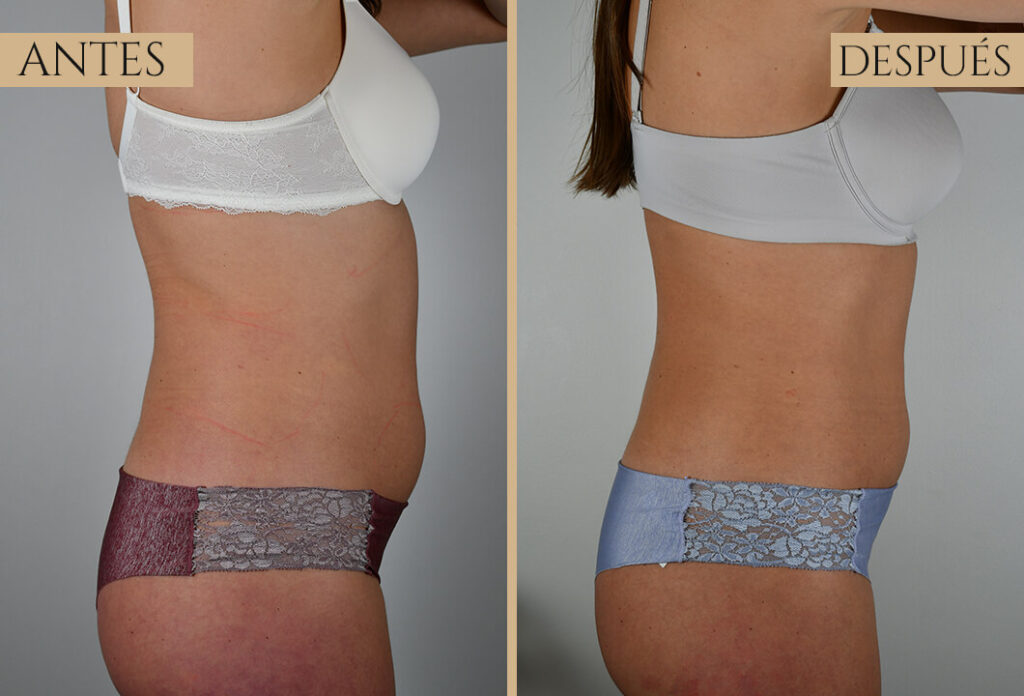 Antes-despues exp 2 (2)